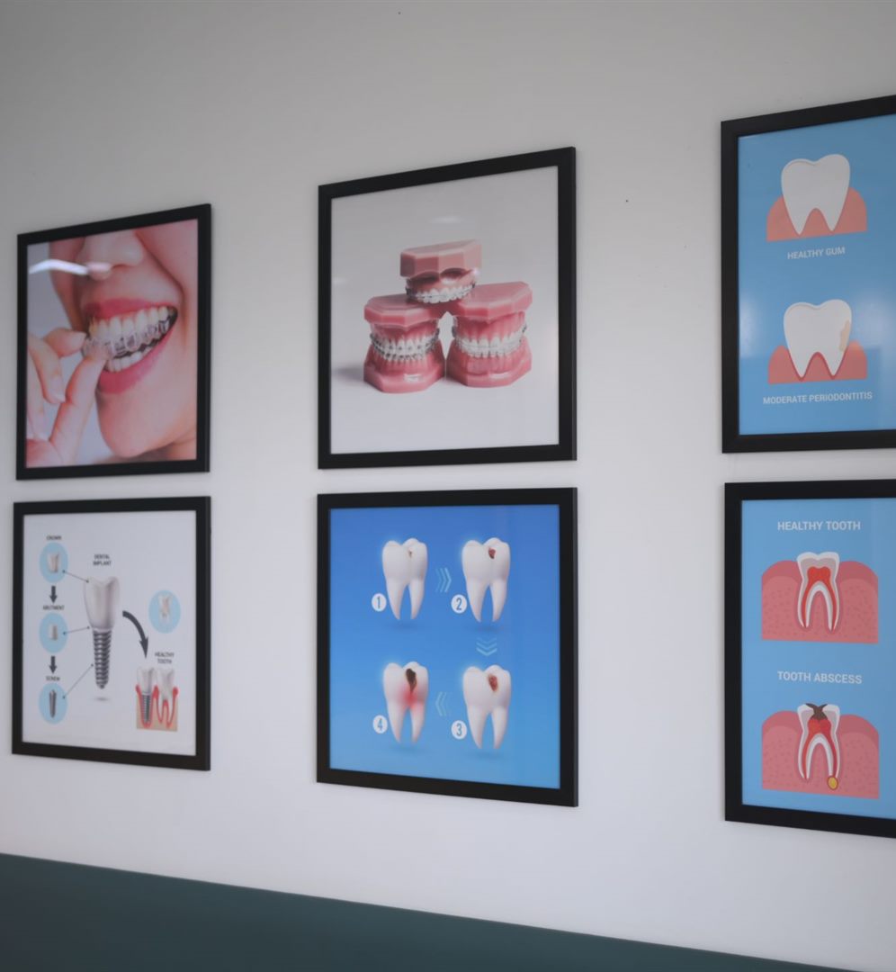 Dental care wall at Family Dental Clinic, Shela Ahmedabad